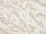 BHD Antibody in Immunohistochemistry (Paraffin) (IHC (P))