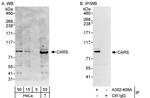 CARS Antibody in Western Blot (WB)