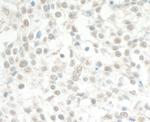 MED13L Antibody in Immunohistochemistry (Paraffin) (IHC (P))