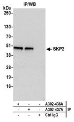 SKP2 Antibody in Immunoprecipitation (IP)