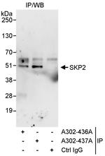 SKP2 Antibody in Immunoprecipitation (IP)