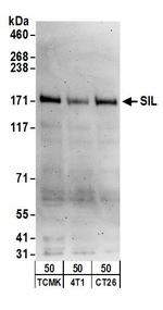 SIL Antibody in Western Blot (WB)