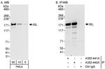 SIL Antibody in Western Blot (WB)