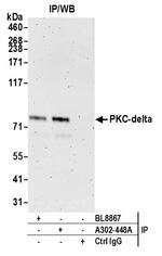 PKC-delta Antibody in Immunoprecipitation (IP)