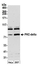 PKC-delta Antibody in Western Blot (WB)