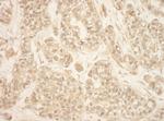 RSK2 Antibody in Immunohistochemistry (Paraffin) (IHC (P))