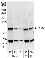 RSK2 Antibody in Western Blot (WB)