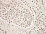 SRPK1 Antibody in Immunohistochemistry (Paraffin) (IHC (P))