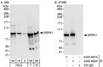 SRPK1 Antibody in Western Blot (WB)