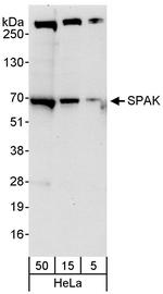 SPAK Antibody in Western Blot (WB)