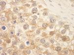 SPAK Antibody in Immunohistochemistry (Paraffin) (IHC (P))