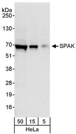 SPAK Antibody in Western Blot (WB)