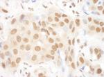 DGCR8 Antibody in Immunohistochemistry (Paraffin) (IHC (P))