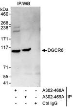 DGCR8 Antibody in Immunoprecipitation (IP)