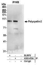 Polycystin-2 Antibody in Immunoprecipitation (IP)