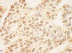 ZEB2/SIP Antibody in Immunohistochemistry (Paraffin) (IHC (P))