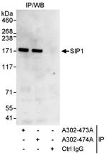 ZEB2/SIP Antibody in Immunoprecipitation (IP)