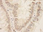 ZEB2/SIP Antibody in Immunohistochemistry (Paraffin) (IHC (P))