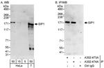 ZEB2/SIP Antibody in Western Blot (WB)