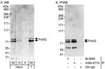 PolA2 Antibody in Western Blot (WB)