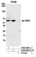 CDK8 Antibody in Immunoprecipitation (IP)