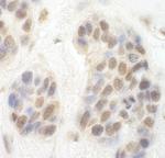 CDK8 Antibody in Immunohistochemistry (Paraffin) (IHC (P))