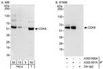 CDK8 Antibody in Western Blot (WB)