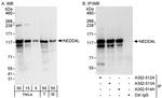 NEDD4L Antibody in Western Blot (WB)