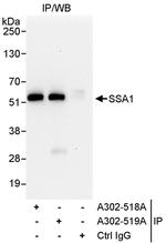 SSA1 Antibody in Immunoprecipitation (IP)