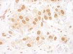 RuvBL2 Antibody in Immunohistochemistry (Paraffin) (IHC (P))