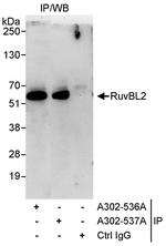 RuvBL2 Antibody in Immunoprecipitation (IP)