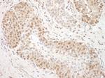 TFIP11 Antibody in Immunohistochemistry (Paraffin) (IHC (P))