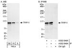 TFIP11 Antibody in Western Blot (WB)