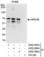 ARID3B Antibody in Immunoprecipitation (IP)