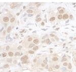 ARID3B Antibody in Immunohistochemistry (Paraffin) (IHC (P))