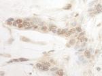 ARID3B Antibody in Immunohistochemistry (Paraffin) (IHC (P))