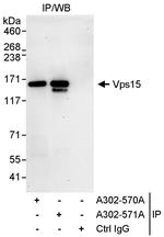 Vps15 Antibody in Immunoprecipitation (IP)