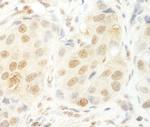 HCA66 Antibody in Immunohistochemistry (Paraffin) (IHC (P))