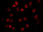 BRD2 Antibody in Immunocytochemistry (ICC/IF)