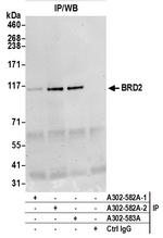 BRD2 Antibody in Immunoprecipitation (IP)