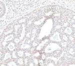 BRD2 Antibody in Immunohistochemistry (Paraffin) (IHC (P))