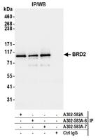 BRD2 Antibody in Immunoprecipitation (IP)