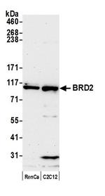 BRD2 Antibody in Western Blot (WB)