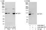 TOP1 Antibody in Western Blot (WB)