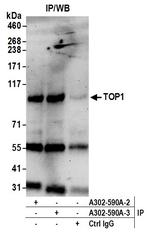 TOP1 Antibody in Immunoprecipitation (IP)