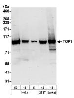 TOP1 Antibody in Western Blot (WB)