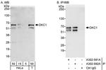 DKC1 Antibody in Western Blot (WB)