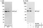 Dcp2 Antibody in Western Blot (WB)