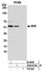 MK5 Antibody in Immunoprecipitation (IP)