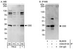 CEE Antibody in Western Blot (WB)